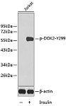 Western blot - Phospho-DOK2-Y299 Rabbit pAb (AP0250)