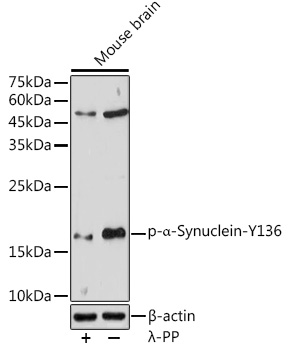 Phospho-α-Synuclein-Y136 Rabbit pAb