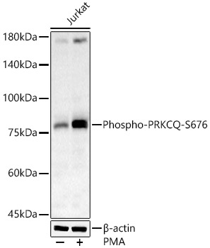 Phospho-PRKCQ-S676 Rabbit pAb