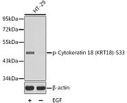 Western blot - Phospho-Cytokeratin 18 (KRT18)-S33 Rabbit pAb (AP0263)