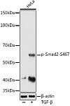 Western blot - Phospho-Smad2-S467 Rabbit pAb (AP0269)