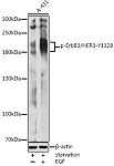 Western blot - Phospho-ErbB3/HER3-Y1328 Rabbit pAb (AP0277)