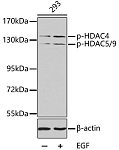Western blot - Phospho-HDAC4-S246/HDAC5-S259/HDAC9-S220 Rabbit pAb (AP0280)