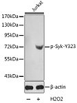 Western blot - Phospho-Syk-Y323 Rabbit pAb (AP0291)
