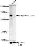 Western blot - Phospho-FAK-Y397 Rabbit pAb (AP0302)