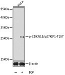 Western blot - Phospho-CDKN1B/p27KIP1-T187 Rabbit pAb (AP0328)
