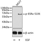 Western blot - Phospho-ESRα-S106 Rabbit pAb (AP0347)