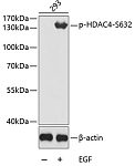 Western blot - Phospho-HDAC4-S632 Rabbit pAb (AP0359)