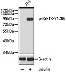 Western blot - Phospho-IGF1R-Y1280 Rabbit pAb (AP0368)