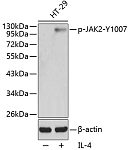 Western blot - Phospho-JAK2-Y1007 Rabbit pAb (AP0373)