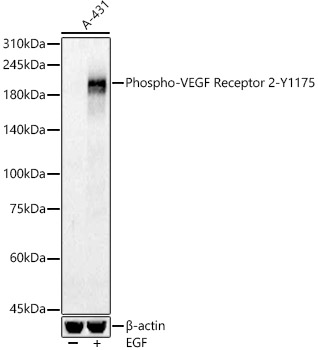 Phospho-VEGF Receptor 2-Y1175 Rabbit pAb