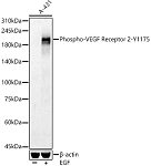 Western blot - Phospho-VEGF Receptor 2-Y1175 Rabbit pAb (AP0382)