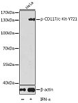 Western blot - Phospho-CD117/c-Kit-Y721 Rabbit pAb (AP0385)