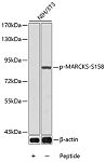 Western blot - Phospho-MARCKS-S158 Rabbit pAb (AP0402)