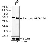Western blot - Phospho-MARCKS-S162 Rabbit pAb (AP0403)