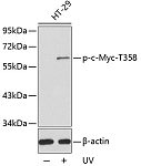 Western blot - Phospho-c-Myc-T358 Rabbit pAb (AP0411)