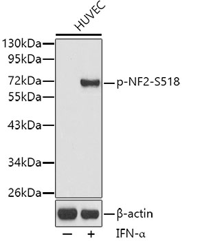 Phospho-NF2-S518 Rabbit pAb