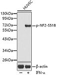 Western blot - Phospho-NF2-S518 Rabbit pAb (AP0414)