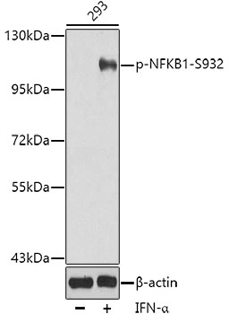 Phospho-NFKB1-S932 Rabbit pAb