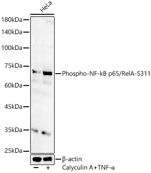 Phospho-NF-kB p65/RelA-S311 Rabbit pAb