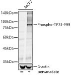 Western blot - Phospho-TP73-Y99 Rabbit pAb (AP0465)