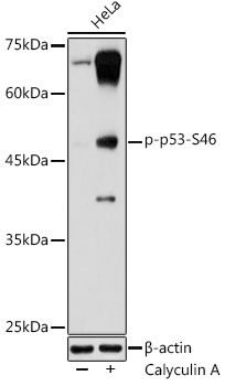Phospho-p53-S46 Rabbit pAb