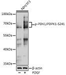 Western blot - Phospho-PDK1/PDPK1-S241 Rabbit pAb (AP0477)