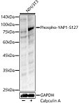 Western blot - Phospho-YAP1-S127 Rabbit pAb (AP0489)