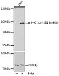Western blot - Phospho-PKC (pan) (βII Ser660) Rabbit pAb (AP0495)