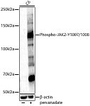 Western blot - Phospho-JAK2-Y1007/1008 Rabbit pAb (AP0531)