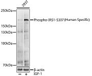 Western blot - Phospho-IRS1-S307(Human Specific) Rabbit pAb (AP0552)