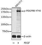 Western blot - Phospho-PDGFRB-Y740 Rabbit pAb (AP0556)