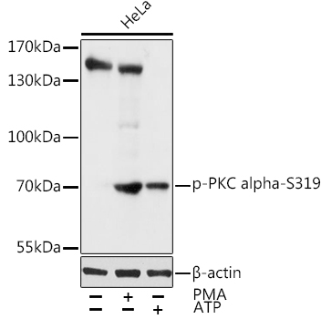 Phospho-PKC alpha-S319 Rabbit pAb