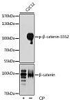 Western blot - Phospho-β-Catenin-S552 Rabbit pAb (AP0579)