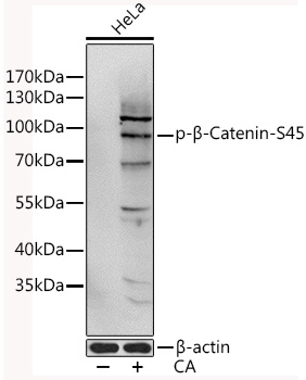 Phospho-β-Catenin-S45 Rabbit pAb