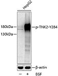 Western blot - Phospho-TNK2-Y284 Rabbit pAb (AP0589) 