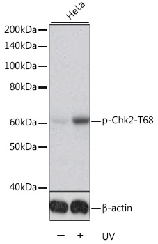 Phospho-Chk2-T68 Rabbit pAb