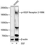 Western blot - Phospho-VEGF Receptor 2-Y996 Rabbit pAb (AP0595)