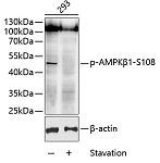 Western blot - Phospho-AMPKβ1-S108 Rabbit pAb (AP0597)