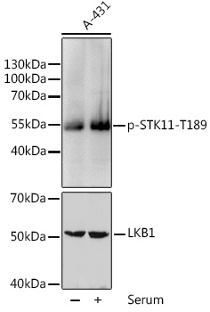 Phospho-STK11-T189 Rabbit pAb