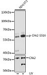 Western blot - Phospho-Chk2-S516 Rabbit pAb (AP0604)