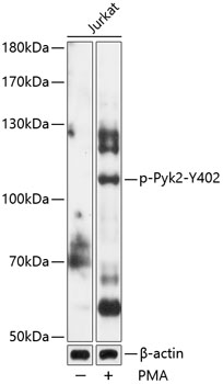 Phospho-Pyk2-Y402 Rabbit pAb