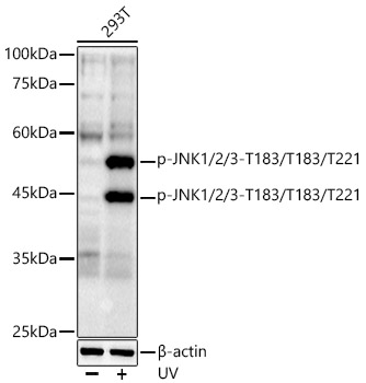 Phospho-JNK1/2/3-T183/T183/T221 Rabbit monoclonal antibody
