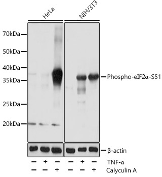 Phospho-eIF2A Alpha-S51 Rabbit monoclonal antibody