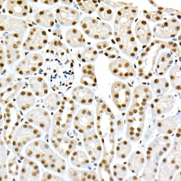 Phospho-Smad3-S423/S425 Rabbit monoclonal antibody