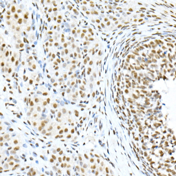 Phospho-Smad3-S423/S425 Rabbit monoclonal antibody