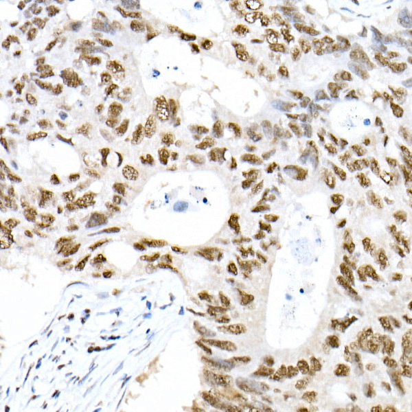 Phospho-Smad3-S423/S425 Rabbit monoclonal antibody
