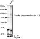 Western blot - Phospho-Glucocorticoid Receptor-S211 Rabbit pAb (AP0759)