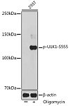 Western blot - Phospho-ULK1-S555 Rabbit pAb (AP0760)