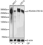 Western blot - Phospho-POLR2A CTD-S5 Rabbit pAb (AP0828)
